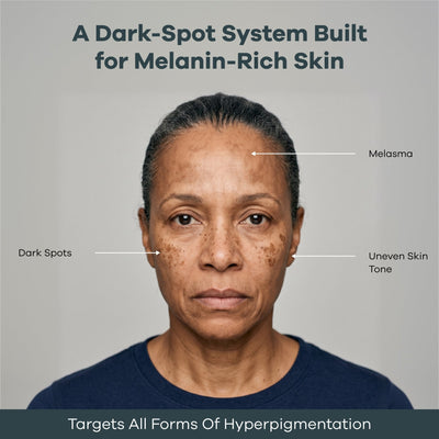 The Micro Infusion System™ Pigmentation For Melanin-Rich Skin