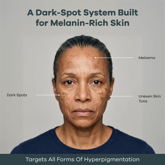 The Micro Infusion System™ Pigmentation For Melanin-Rich Skin